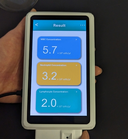 The CytoTracker Leukometer, a portable device that quickly delivers readings based on a single drop of blood.